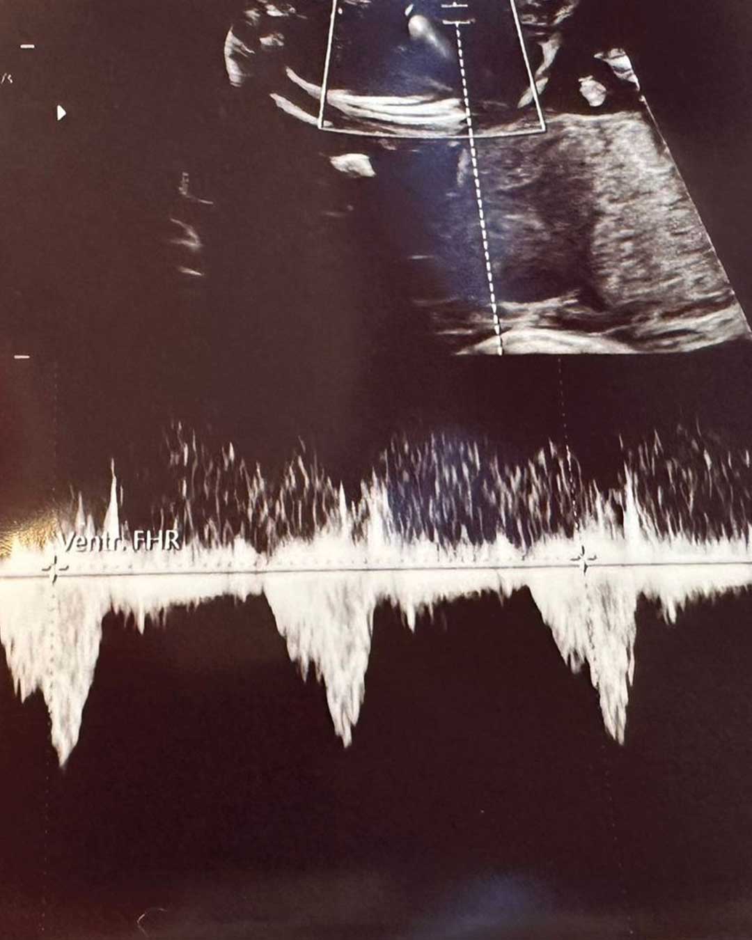 Ultraschallaufnahme des Herzschlag eines Babys als Grundlage für einen Anhänger als Sonderanfertigung für eine Kundin von Maren Jewellery